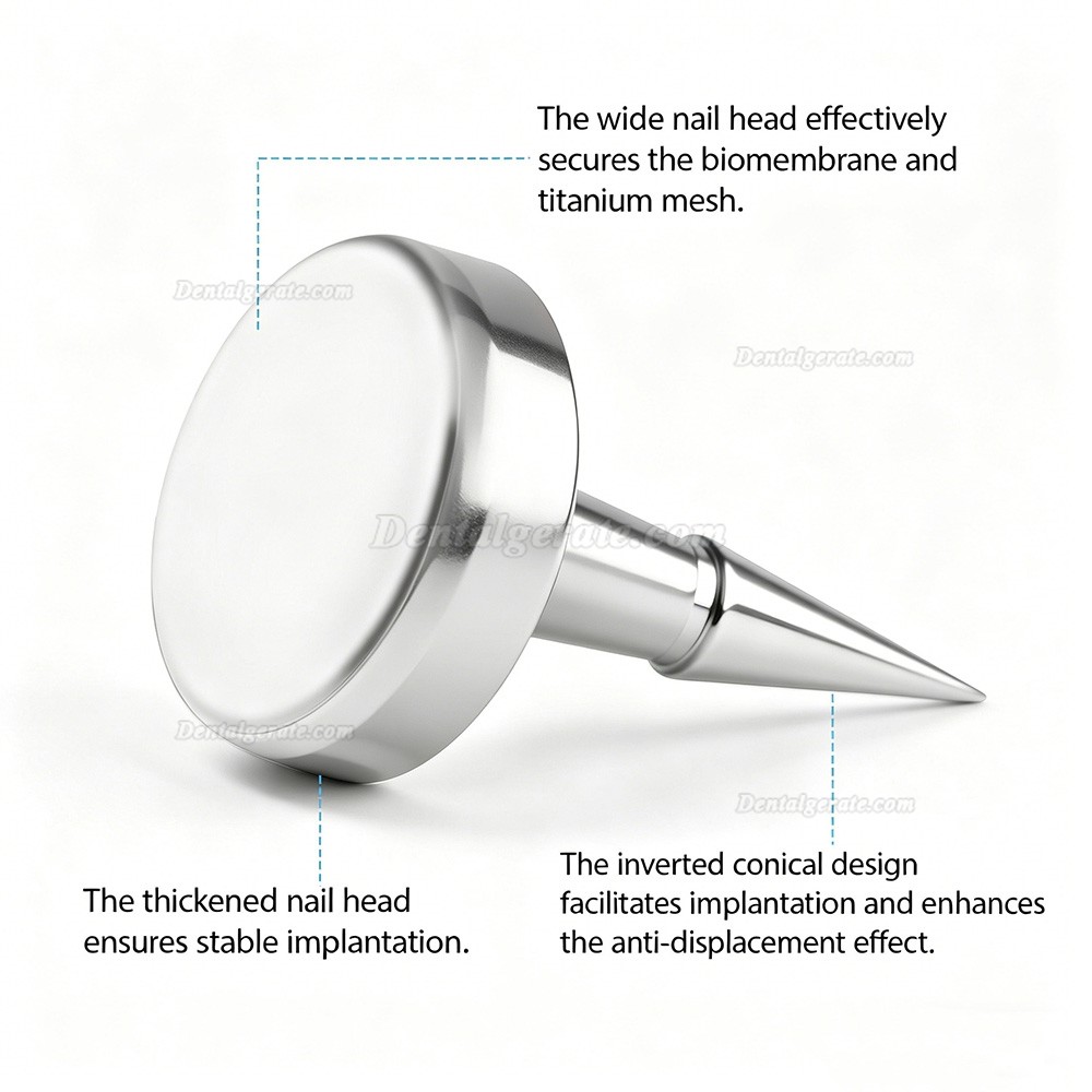 SEGMA Automatisches Mini-Membranfixationssystem, 30 St&uuml;ck Knochenstifte 3mm / 4mm f&uuml;r FGG & GBR
